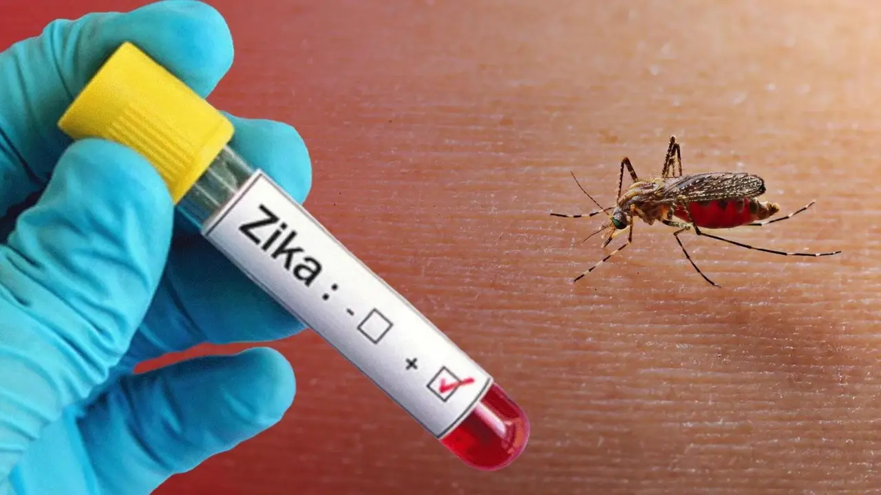 Zika virus symptoms