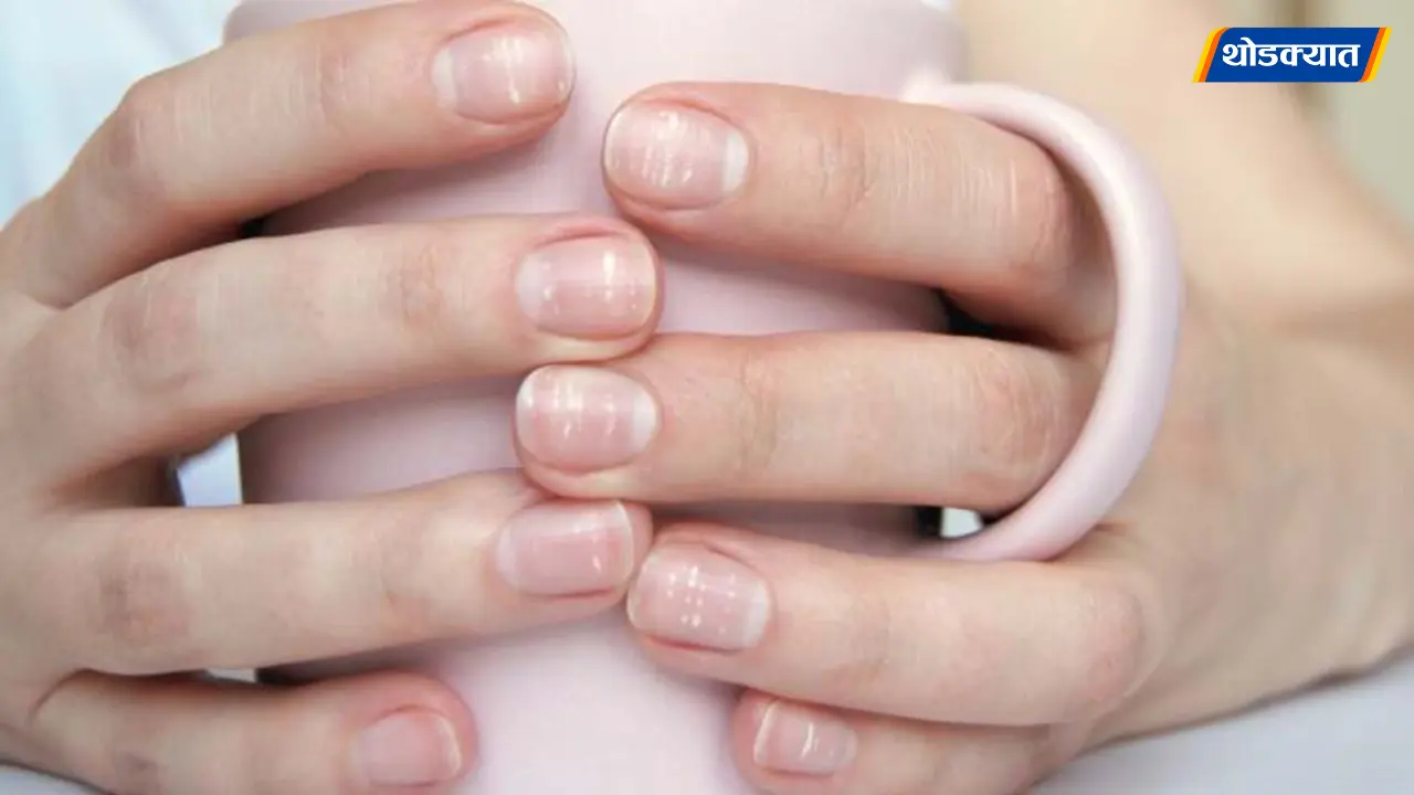 Nail Health