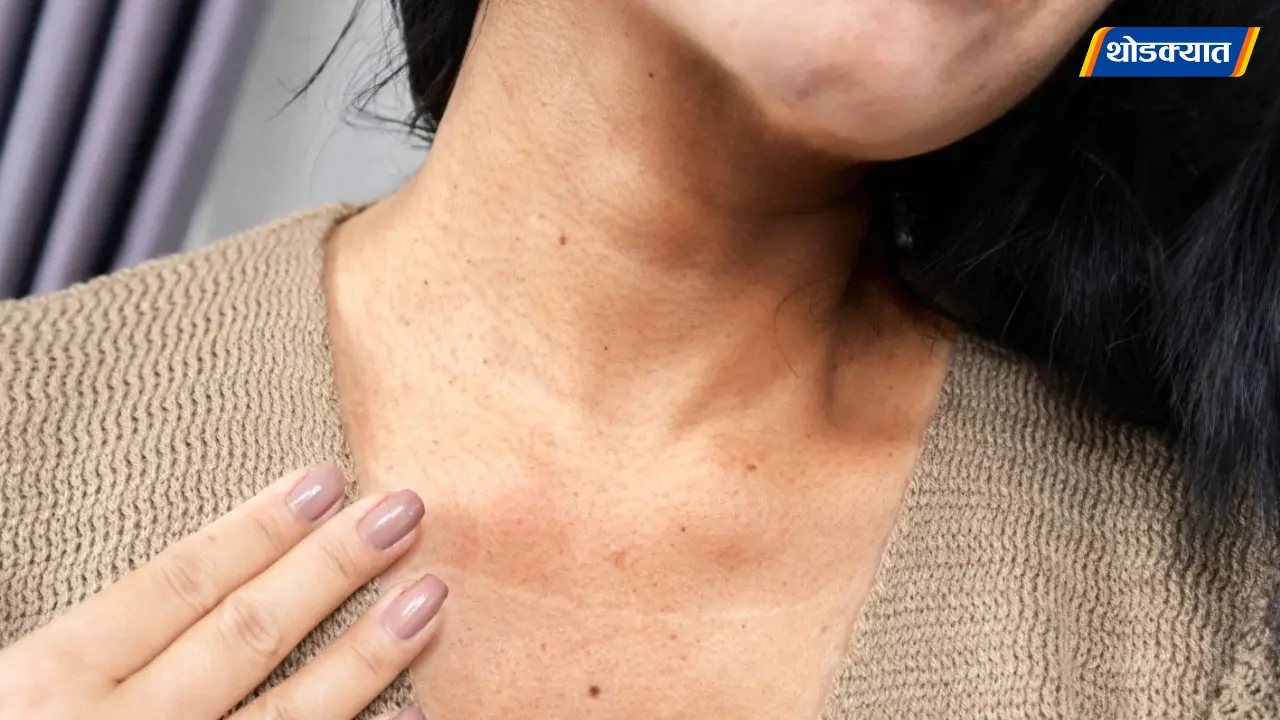 Dark Neck